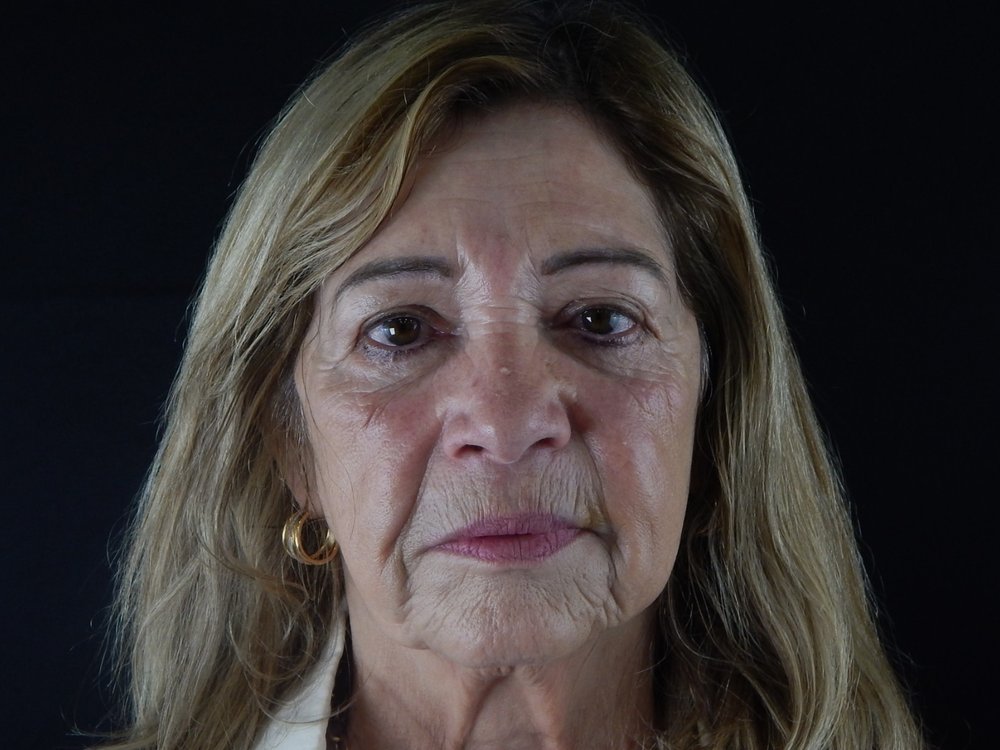 Caso 2 — Antes