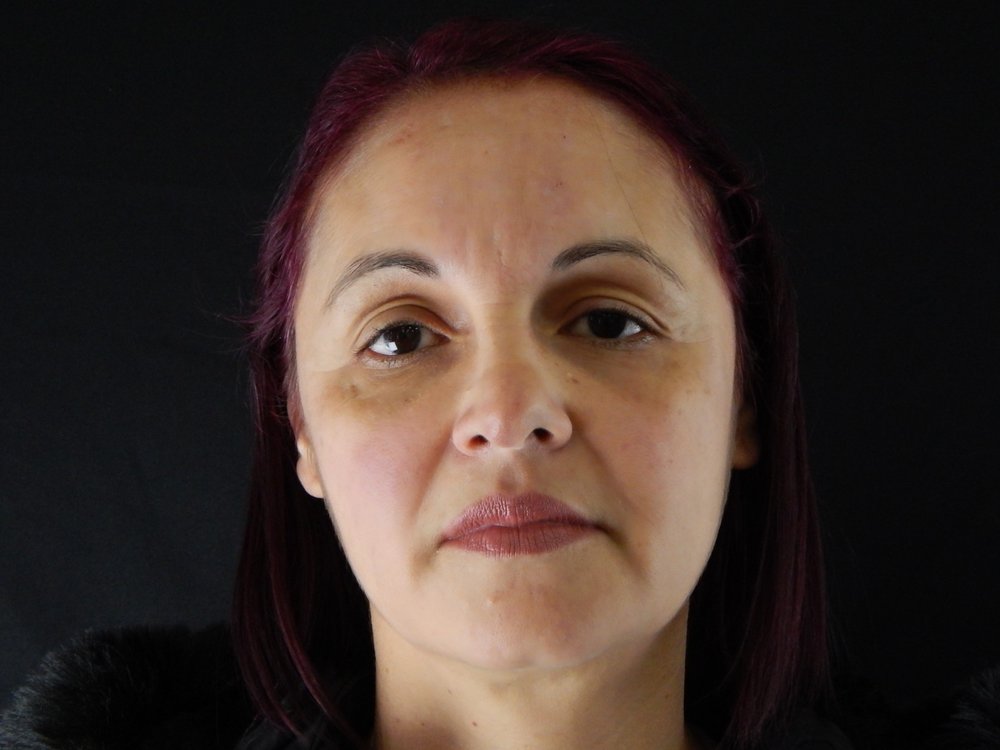 Caso 3 — Depois
